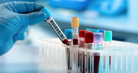 Laboratoires : les actes délocalisés désormais encadrés