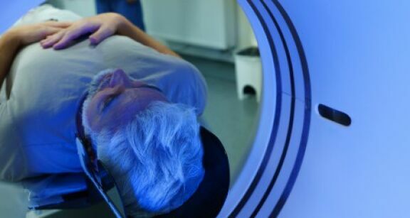 Dépistage du cancer du poumon : la France passe à l’action