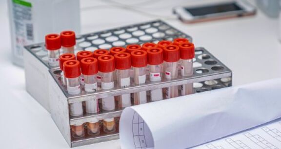 39 nouvelles mol&eacute;cules autoris&eacute;es l’an dernier en Europe